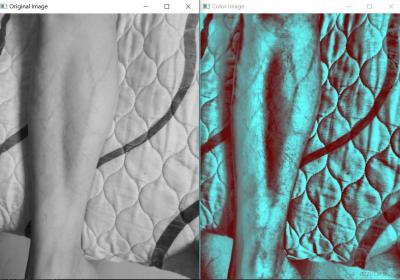 python识别增强静脉清晰度 opencv-python图像处理案例