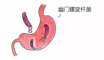 「科普大发现：咳嗽和胃病竟然有关系？」- 从胃肠角度解释咳嗽,「科普大发现：咳嗽和胃病竟然有关系？」- 从胃肠角度解释咳嗽,第1张