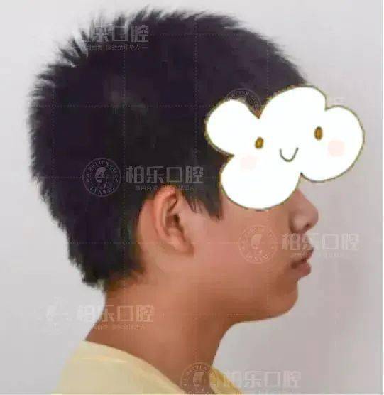 重写标题: 新氧网成功上市，牙齿矫正行业进入IPO排队名单,重写标题: 新氧网成功上市，牙齿矫正行业进入IPO排队名单,第3张