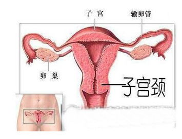 [新标题] 妇科检查常识，你必须了解的三点！,[新标题] 妇科检查常识，你必须了解的三点！,第3张