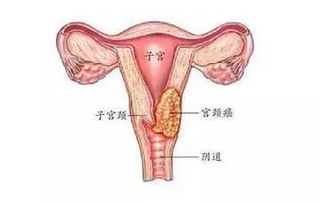 女性健康，你应该掌握的九个必备知识！,女性健康，你应该掌握的九个必备知识！,第1张