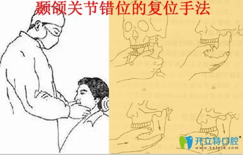 颞下颌关节错位的危害及预防治疗方法,颞下颌关节错位的危害及预防治疗方法,第1张