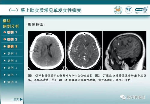 探究神经网络算法在图像识别中的应用,探究神经网络算法在图像识别中的应用,第2张