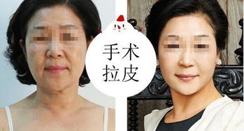 原辰整形：擅长细节打磨，为你带来自然微整,原辰整形：擅长细节打磨，为你带来自然微整,第3张