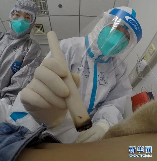 手拉手共同面对白癜风：探讨治疗方法与生活习惯,手拉手共同面对白癜风：探讨治疗方法与生活习惯,第2张