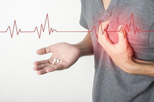 如何识别心梗早期信号？,如何识别心梗早期信号？,第3张