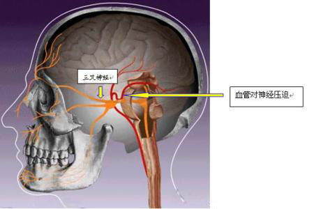 探究神经网络算法在图像识别中的应用,探究神经网络算法在图像识别中的应用,第3张