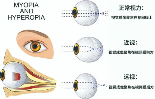 瞳术之谜-探究宇智波斑的眼睛,瞳术之谜-探究宇智波斑的眼睛,第1张