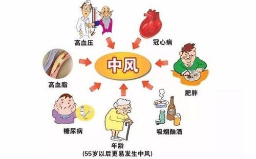 如何挑选适合自己的内衣？从尚衣监内衣品牌说起,如何挑选适合自己的内衣？从尚衣监内衣品牌说起,第1张