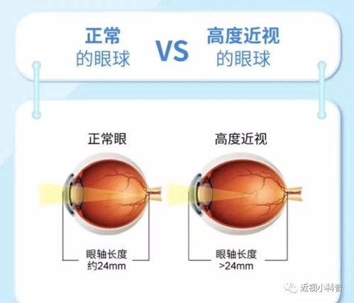 瞳术之谜-探究宇智波斑的眼睛,瞳术之谜-探究宇智波斑的眼睛,第2张