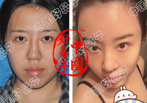 如何看待裴涩琪整容？,如何看待裴涩琪整容？,第2张